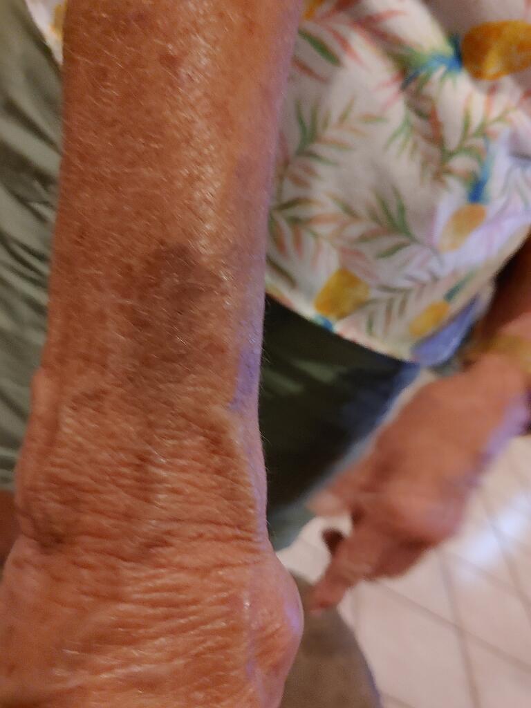 20200624_200638.jpg - , FC : (c, 0.91, d, 0.00, Detect, 1, appIcon, 0, after, 0, chg, 1, out, 0, Freq, 120, raw, 120, WB, 1, Clear, 1, ori, 15, 9.06, 15, 9.06, chg, 30, 18.13, 30, 18.13,,0.50)